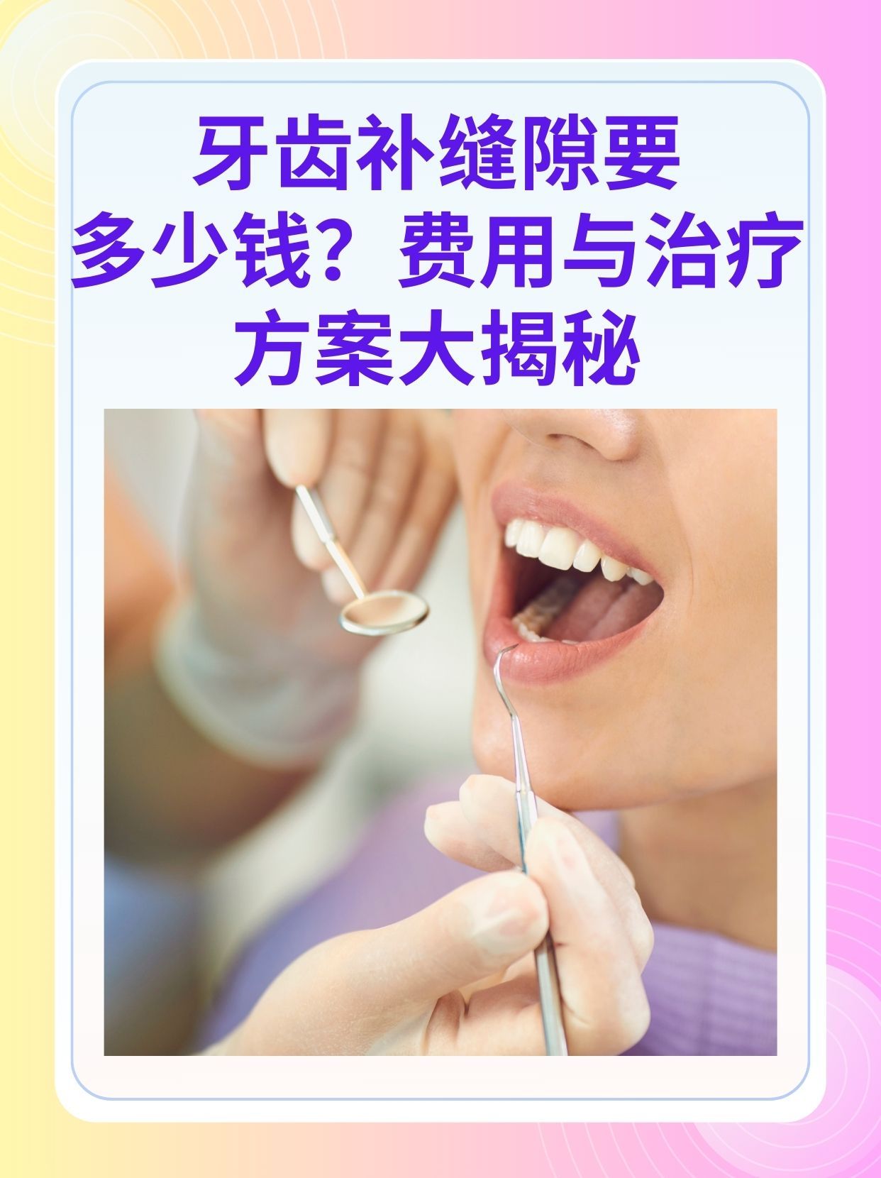 南平补牙医保可以报销吗(补牙医保可以报销吗 哪些可以报销呢)